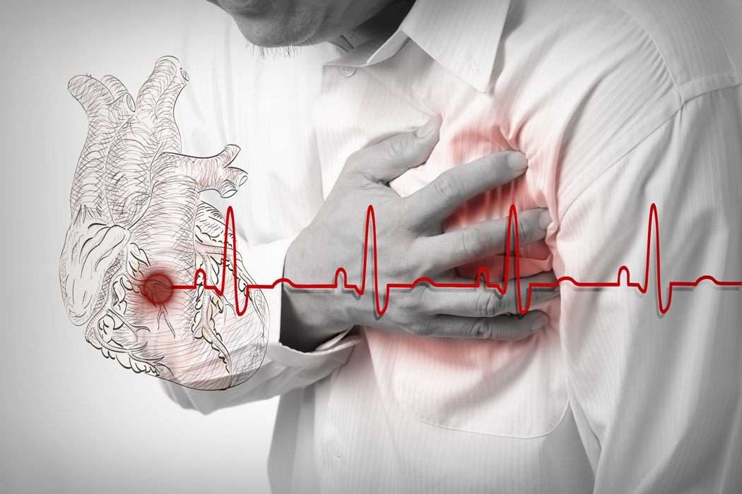 Symptoms of Heart Attack in Tamil: மாரடைப்பு அறிகுறிகள், தடுக்கும்  வழிமுறைகள்