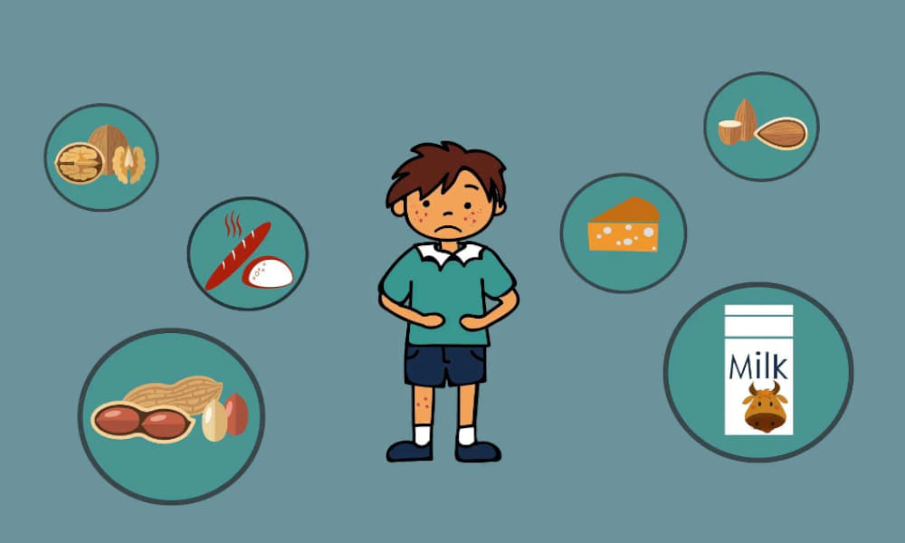 Food Allergy, உணவு ஒவ்வாமை